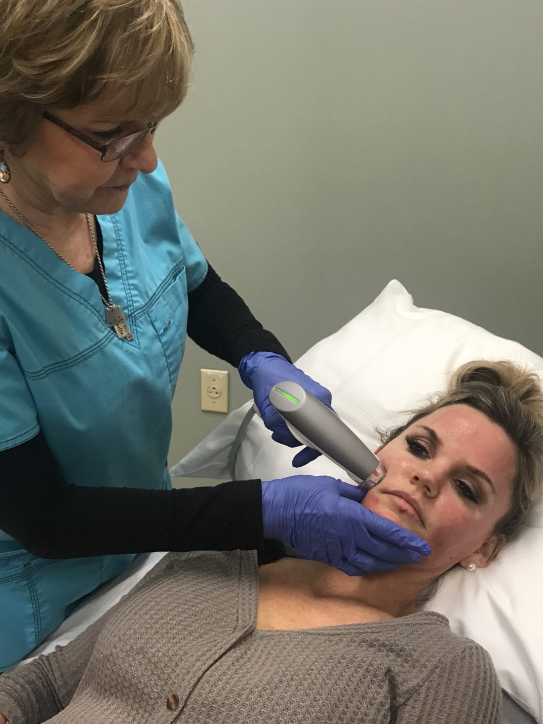 Sublative Skin Rejuvenation Before and After with Genesis Med Spa.